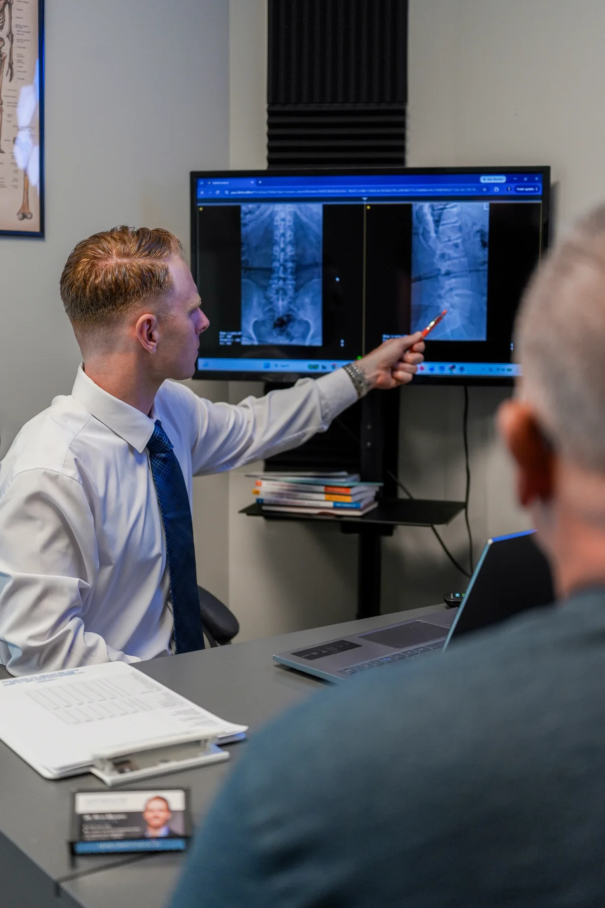 Dr. Ryan Bielecki reviewing lumbar X-rays for a sciatica patient at SpineCo in Downers Grove, IL